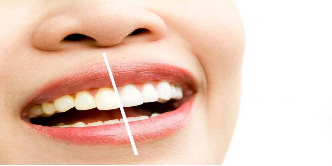 İnci üzere beyaz dişe sahip olmanın sırrı çözüldü. Oysaki bu kadar basitmliş!